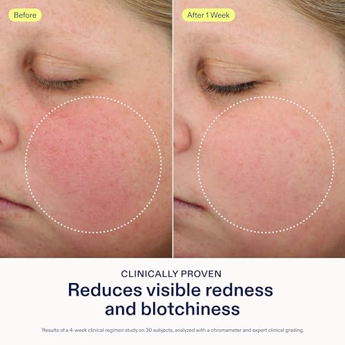 Skinfix Antioxidant Tetrapeptide Soothing Treatment - 1.7 oz - - Product Imagery