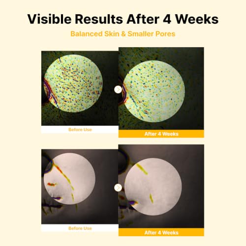 NIDA Peptide Propolis Renewal Serum | Peptide Complex, Propolis - Product Imagery