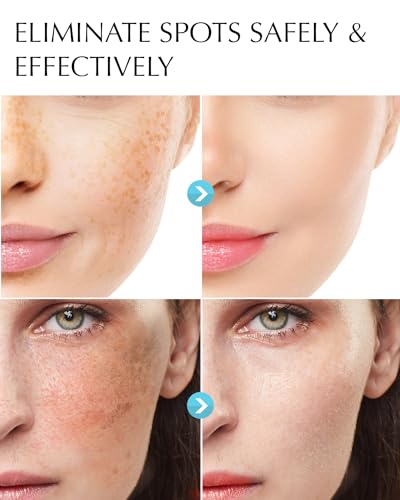 EnaSkin Dark Spot Remover for Face & Body with Niacinamide, - Product Imagery