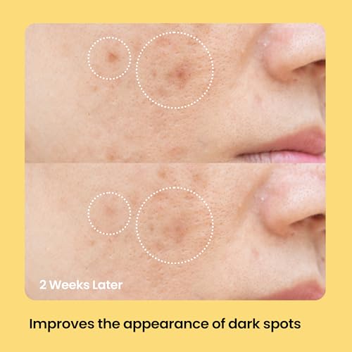 AVARELLE Microneedle Vitamin C Dark Spot Patches for Face 9 Count - Product Imagery