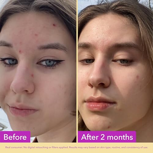 Good Molecules Niacinamide Serum 10%, Pore & Texture Serum, 1 fl - Product Imagery