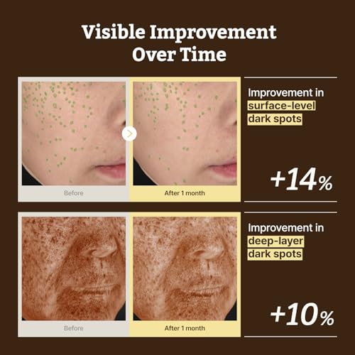 All Advanced Retino-Mela Serum 1 Fl Oz - Product Imagery
