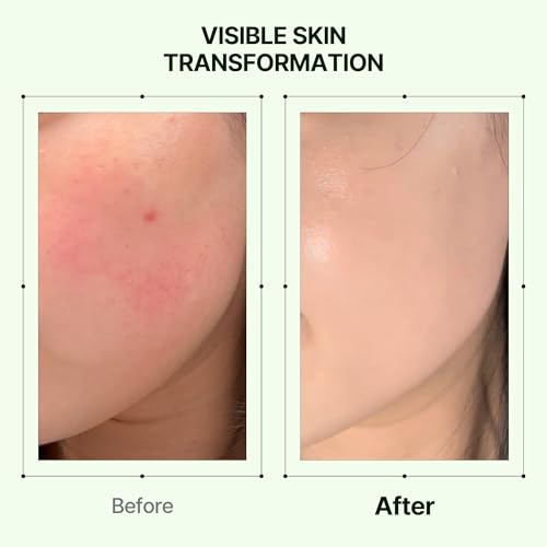 Orien Mugwort Zero Film Moisturizer 60ml Niacinamide 2% - Product Imagery