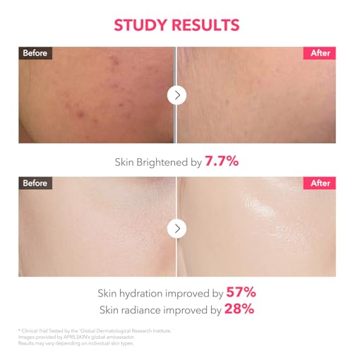 APRILSKIN TXA Pink Capsule Gel Mask 4EA - Product Imagery