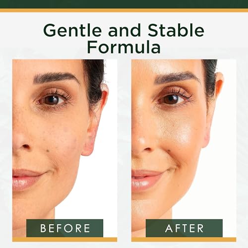 Tree of Life Vitamin C Ultimate Skin Care Collection - 5 Piece - Product Imagery