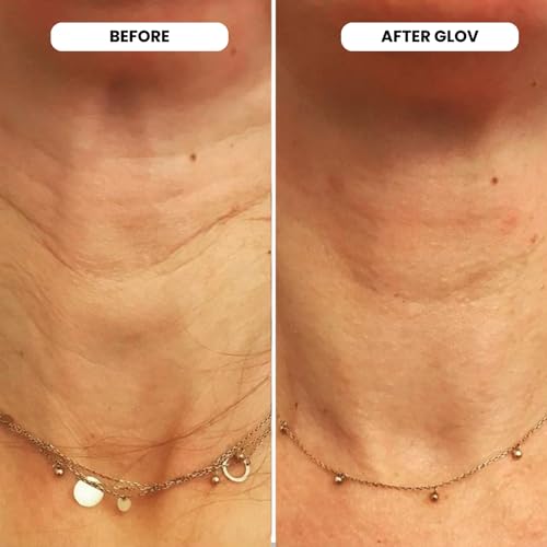 Glov Beauty Micro Infusion System for Face & Lips – 0.25mm 24k - Product Imagery