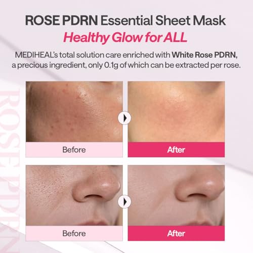 MEDIHEAL Rose PDRN Essential Face Sheet Mask, Healthy Glow (10ea) - Product Imagery