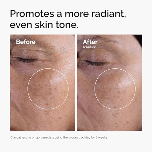 The Ordinary Glycolic Acid 7% Exfoliating Toner, Brightening and - Product Imagery