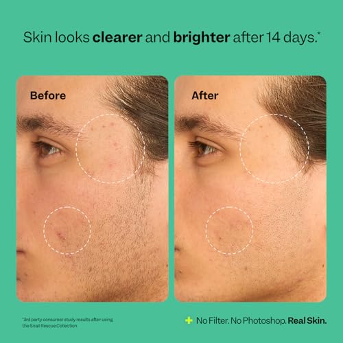 Peach Slices - Snail Rescue Blemish Busting Toner (4.05 oz) - - Product Imagery