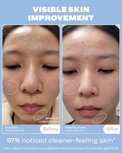 Then I Met You Soothing Tea Cleansing Gel, Korean Skin Care Face - Product Imagery