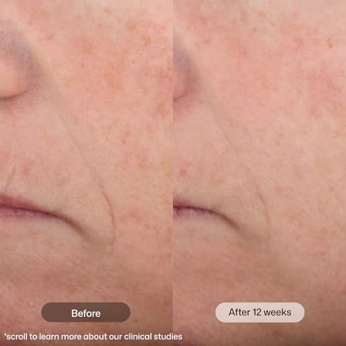 Revision Skincare Intellishade Matte SPF 45 Tinted Sunscreen, - Product Imagery