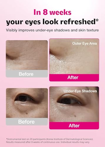 ISOI Blemish Care Eye Patches with Hyaluronic Acid, 90 Count - Product Imagery