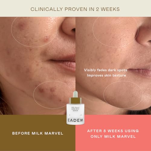 EADEM Dark Spot Remover Serum for Face Infused with Vitamin C & - Product Imagery