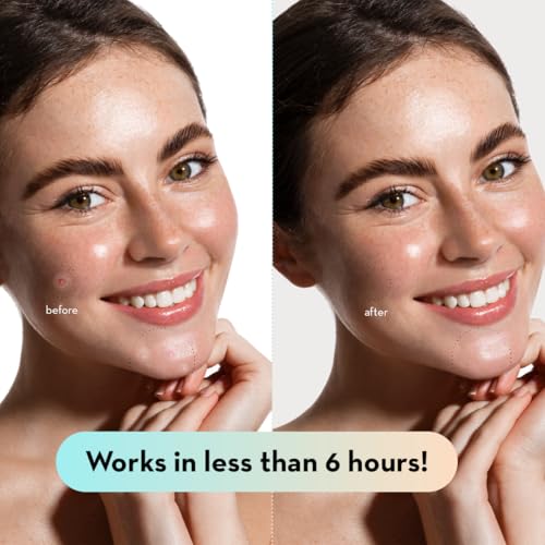 LE GUSHE Korean Pimple Patches for Face (132 Dots) - - Product Imagery