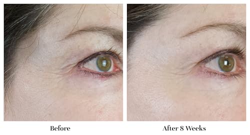 City Beauty Line-Blurring Wrinkle Filler – Spot Solution for - Product Imagery