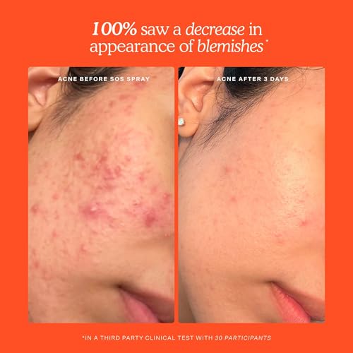 Tower 28 SOS Recovery Hydrating Face Cream for Sensitive Skin - Product Imagery