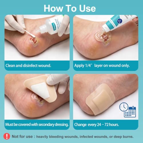 Dimora 2 Packs 6oz Hydrogel First Aid Ointment, Burn Injury - Product Imagery