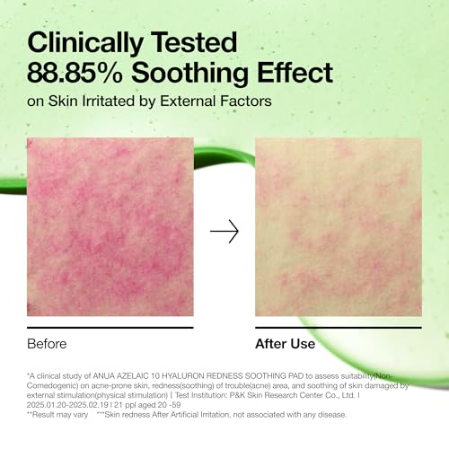 Anua Azelaic Acid 10 Hyaluronic Acid Soothing Toner Pads, 90 Pads - Product Imagery