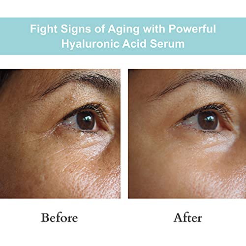JOYAL BEAUTY Hyaluronic Acid Serum for Face Lips Eyes. 100% Pure - Product Imagery