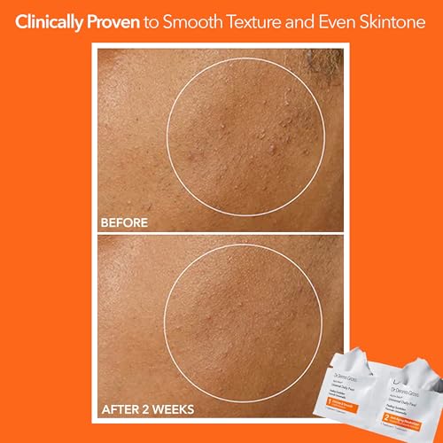 Dr Dennis Gross Alpha Beta Universal Exfoliating Daily Peel - 5 - Product Imagery