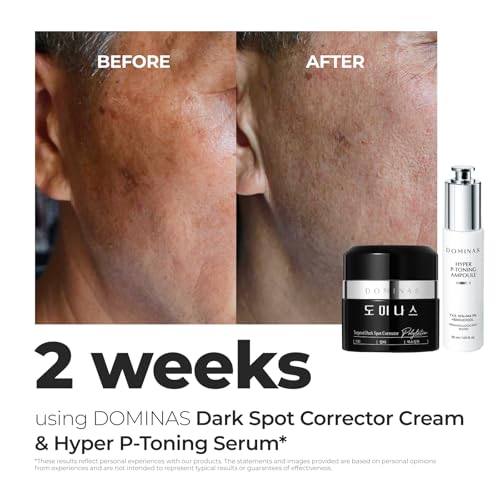 DOMINAS TXA Spot Corrector Cream 1.76 oz - Visibly Reduce Age & - Product Imagery