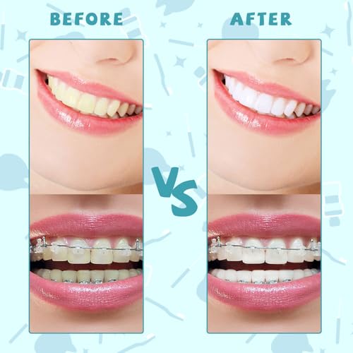 100PCS Interdental Brushes Between Teeth for Braces, Flossers - Product Imagery
