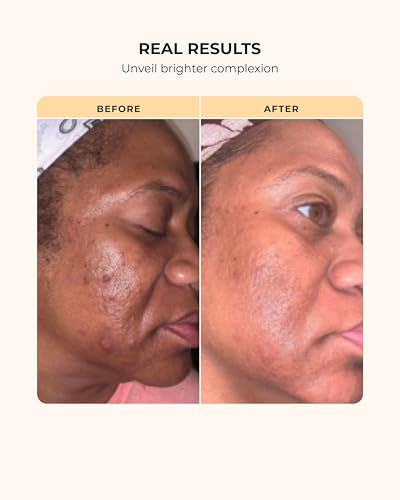 Buttah Skin 3pc Transforming Skincare Kit for Melanin | Rich - Product Imagery