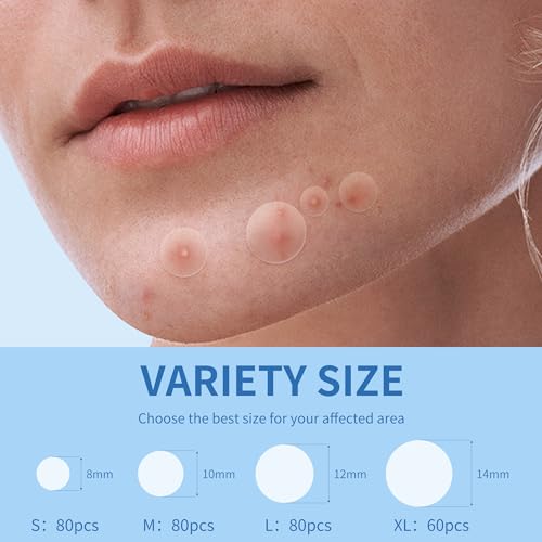 Daolyo Pimple Patches for Face, 4 Size 300 Counts Hydrocolloid - Product Imagery
