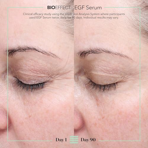 BIOEFFECT EGF Serum, Age-Defying Serum | Wrinkles + Smoothness - Product Imagery