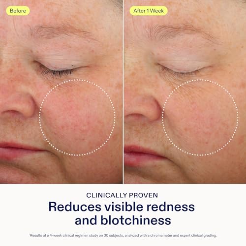 Skinfix Antioxidant Tetrapeptide Soothing Treatment - 1.7 oz - - Product Imagery