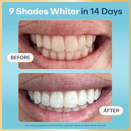 Lumineux Whitening Starter Set, 7 Strip Treatments & Toothpaste - Product Imagery
