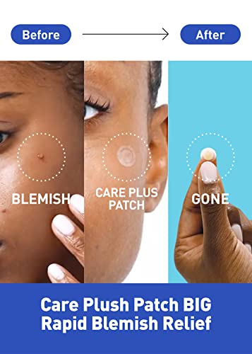 OLIVE YOUNG Care Plus Spot Patch | Hydrocolloid Acne Korean Spot - Product Imagery