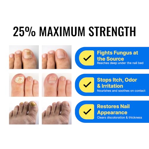 Approved Science Fungix Extra Strength - Undecylenic Acid and - Product Imagery