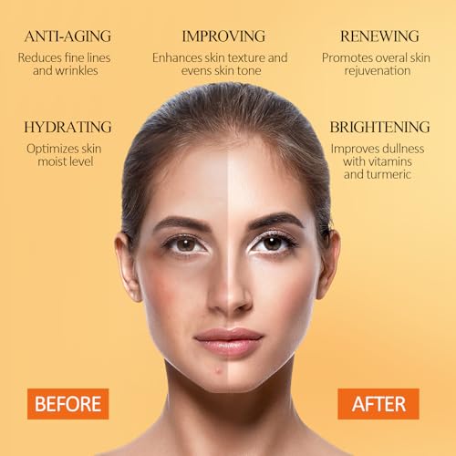 SHVYOG Turmeric Vitamin C Clay Mask with Kaolin Clay for Dull & - Product Imagery