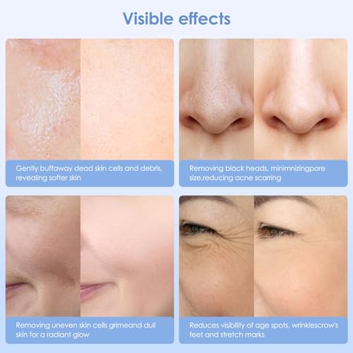 Diamond Microdermabrasion Machine Professional, Adjustable - Product Imagery