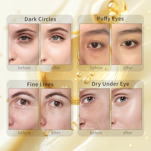 Retinol Under Eye Patches for Puffy Eyes & Dark Circles (60 - Product Imagery