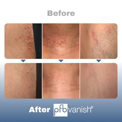 PFB Vanish Razor Bump Treatment (3.28 oz) After Shave Serum - Product Imagery