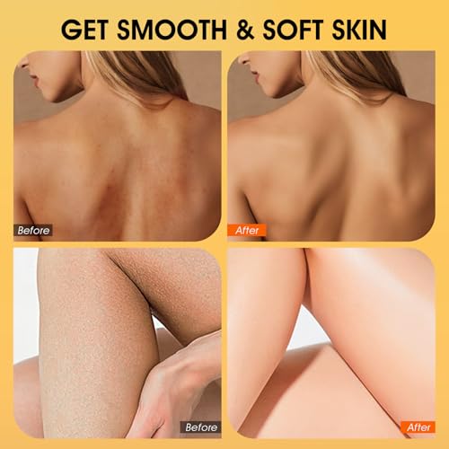 VOERUY Body Scrub, Turmeric Exfoliating Body Scrub, with Coconut - Product Imagery