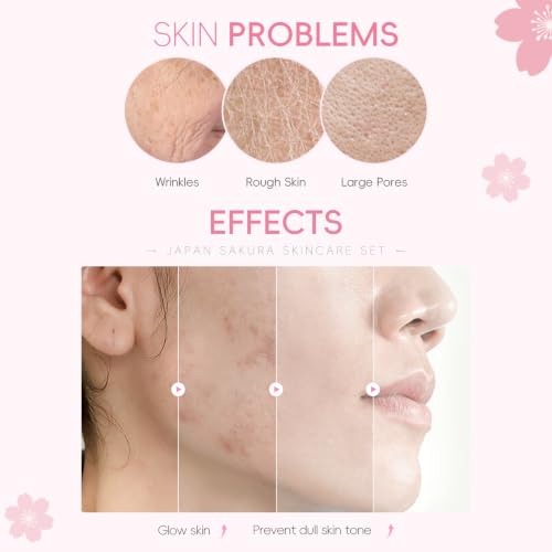 LAIKOU Sakura Skincare Set for Teen Girls, Complete Face Care - Product Imagery