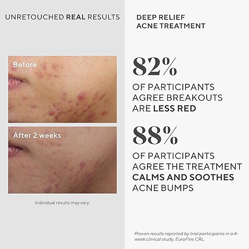 Murad Deep Relief Acne Spot Treatment - 2% Salicylic Acid - 1 Fl - Product Imagery