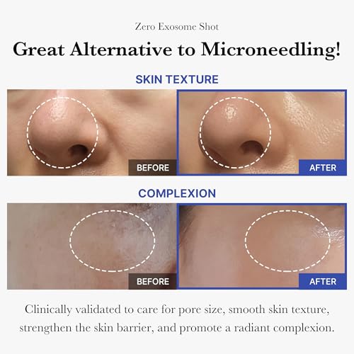medicube Zero Exosome Shot 7,500 Spicule Serum & Collagen Jelly - Product Imagery