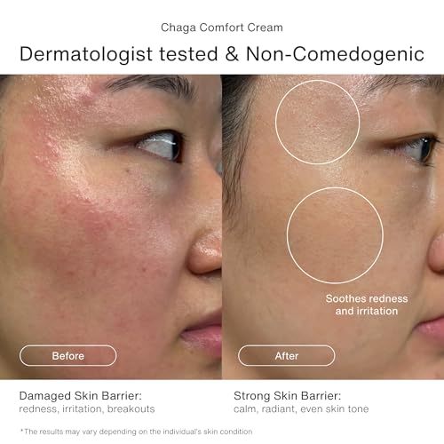 Korean Skincare Set | Under-Eye Care with Zen Reset Eye Patches - Product Imagery