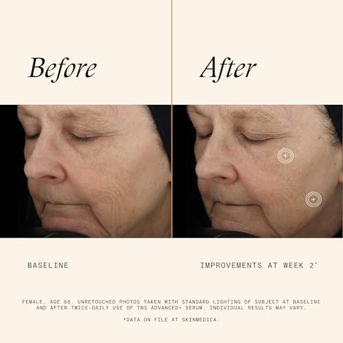 SkinMedica TNS Advanced+ Face Serum - Multi Peptide Serum to - Product Imagery