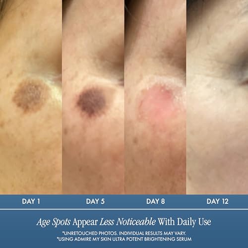 Admire My Skin Dark Spot Corrector Remover for Face Brightening - Product Imagery