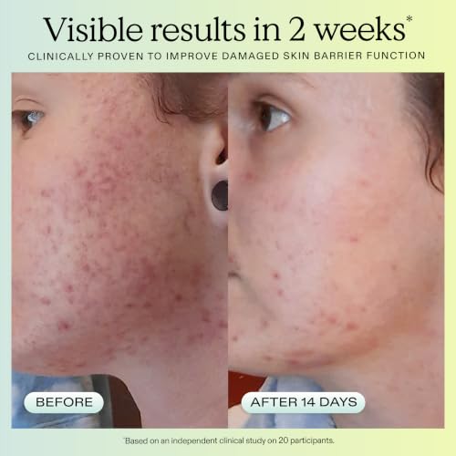 KraveBeauty Great Barrier Relief Face Serum for Dry, Sensitive - Product Imagery