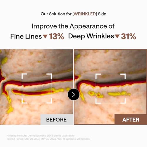 MEDIHEAL 95% Retinol & Collagen Under Eye Patches, Wrinkle Care - Product Imagery