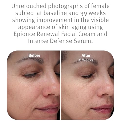 Epionce Renewal Facial Cream Hydrating Anti-Aging Skin Barrier - Product Imagery