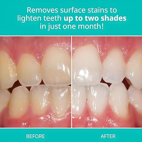 Opalescence Whitening Toothpaste Original 4.7oz - Mint - 1 Pack - Product Imagery