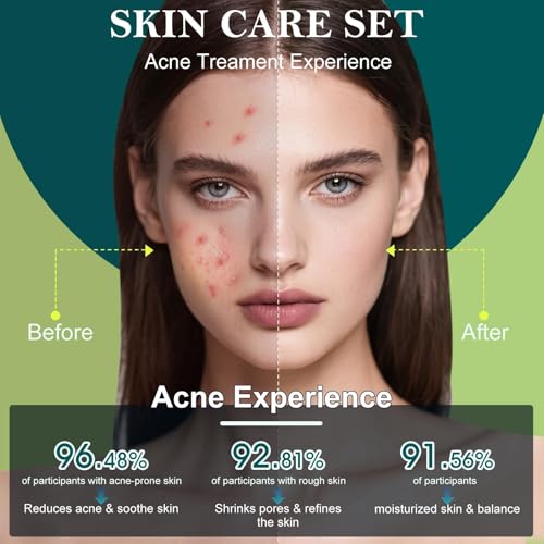 Skin Care Set,Acne Treatment for Face Skin Care Sets & Kits,Tea - Product Imagery