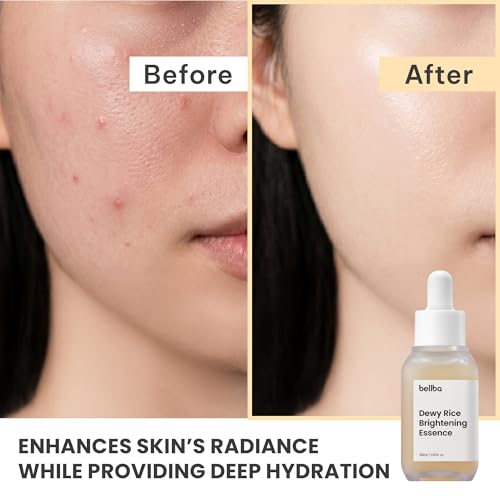 Dewy Rice Glow Serum Korean Face Serum, 1 fl.oz - Product Imagery